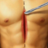 icon Emergency Open Heart Surgery 1.5